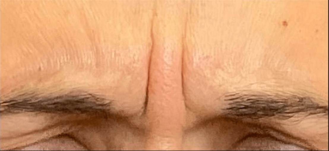 Before Image