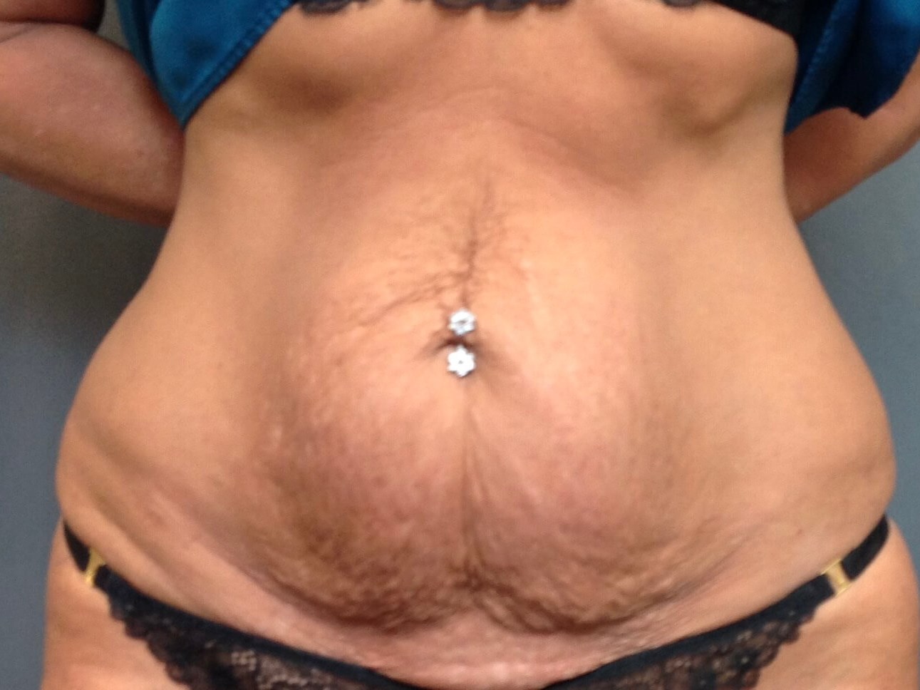 Before Image