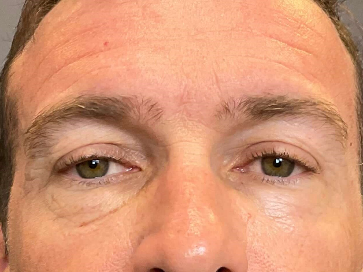 Before Image