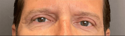After Image