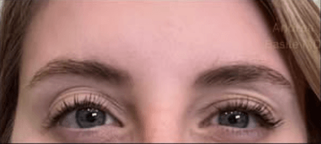 After Image