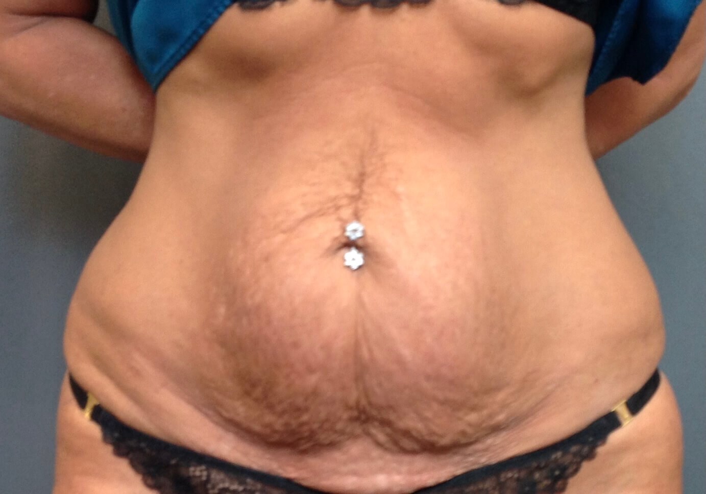 Before Image