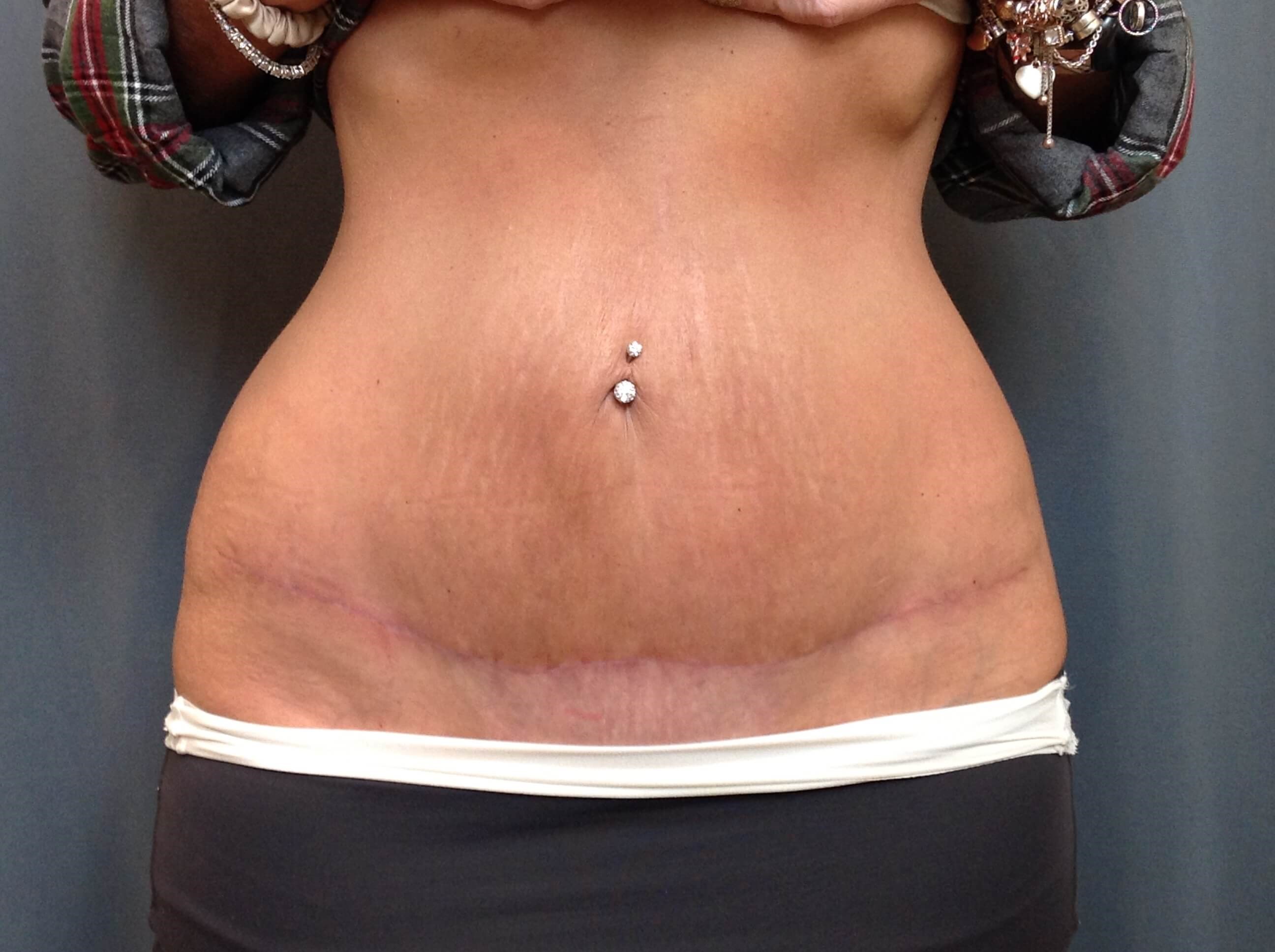 After Image