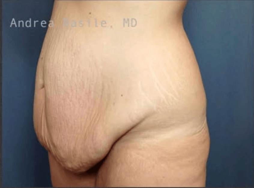 Before Image