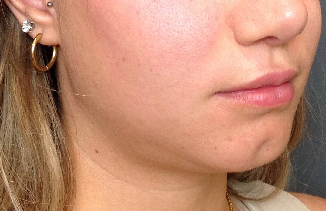 Before Image