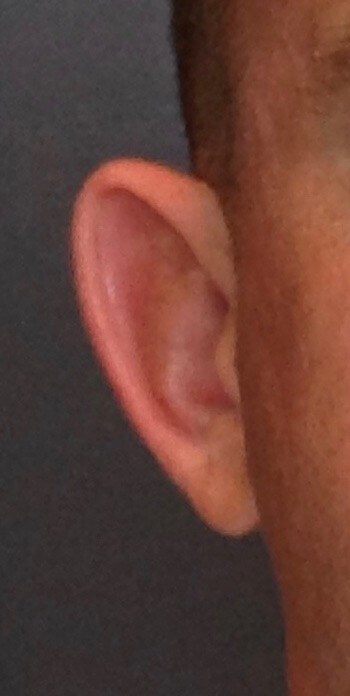 Before Image
