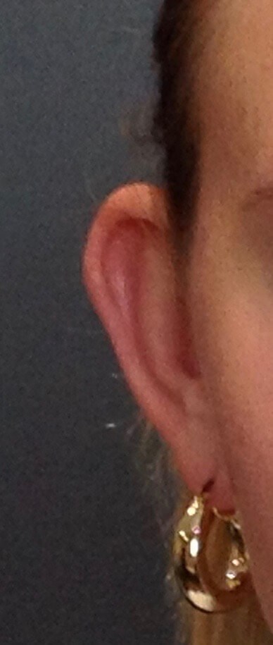 Before Image