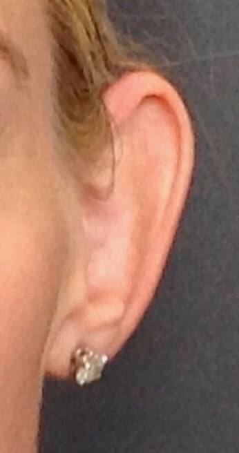 Before Image