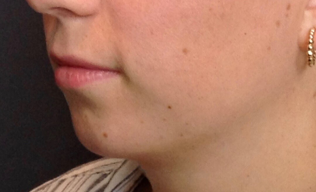Before Image