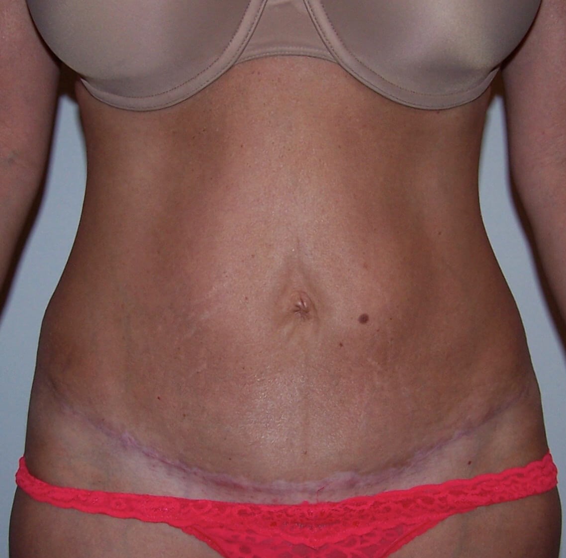 After Image