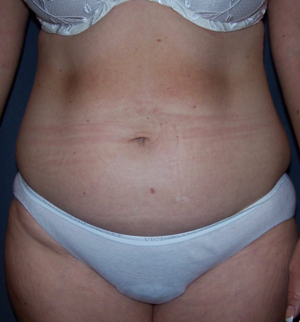 Before Image