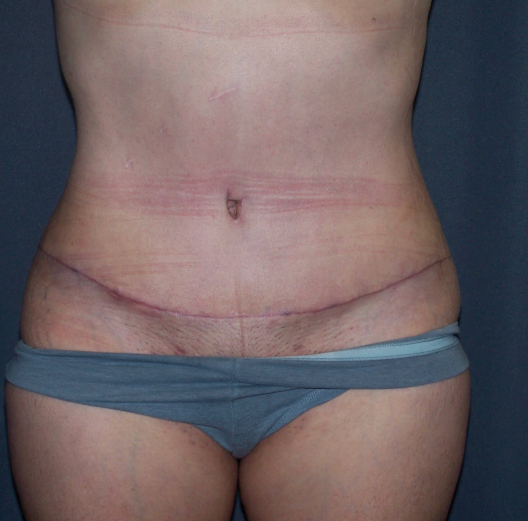 After Image
