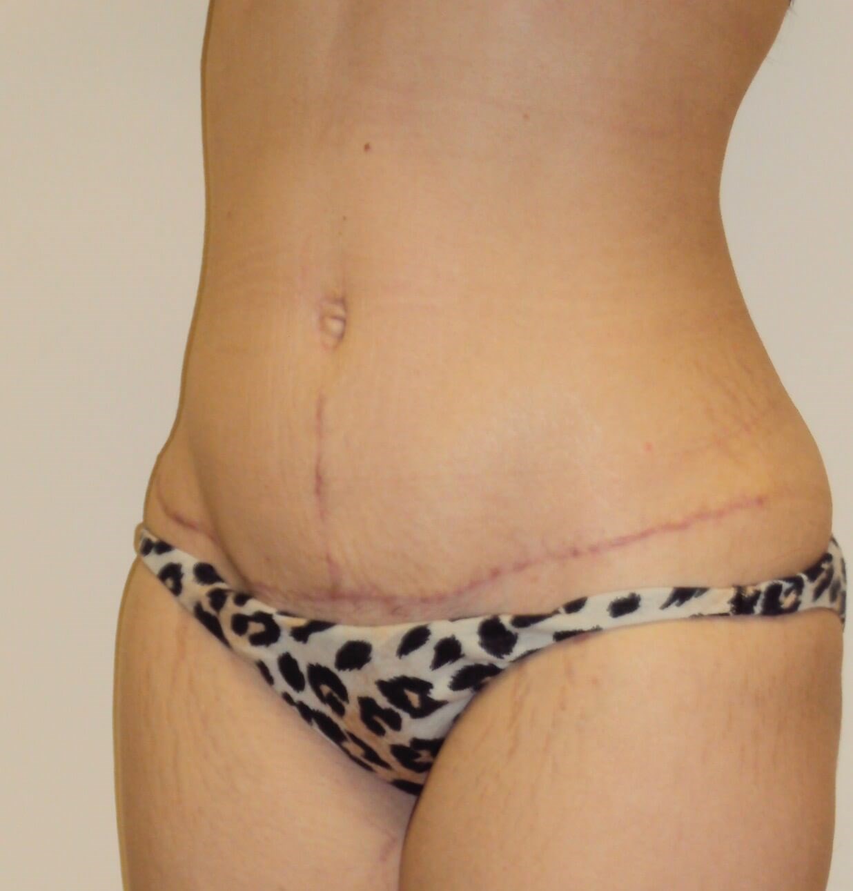 After Image