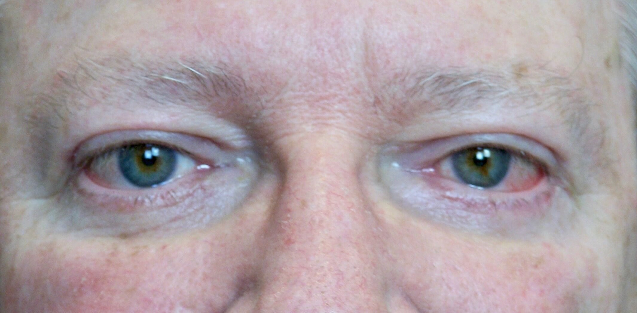 After Image
