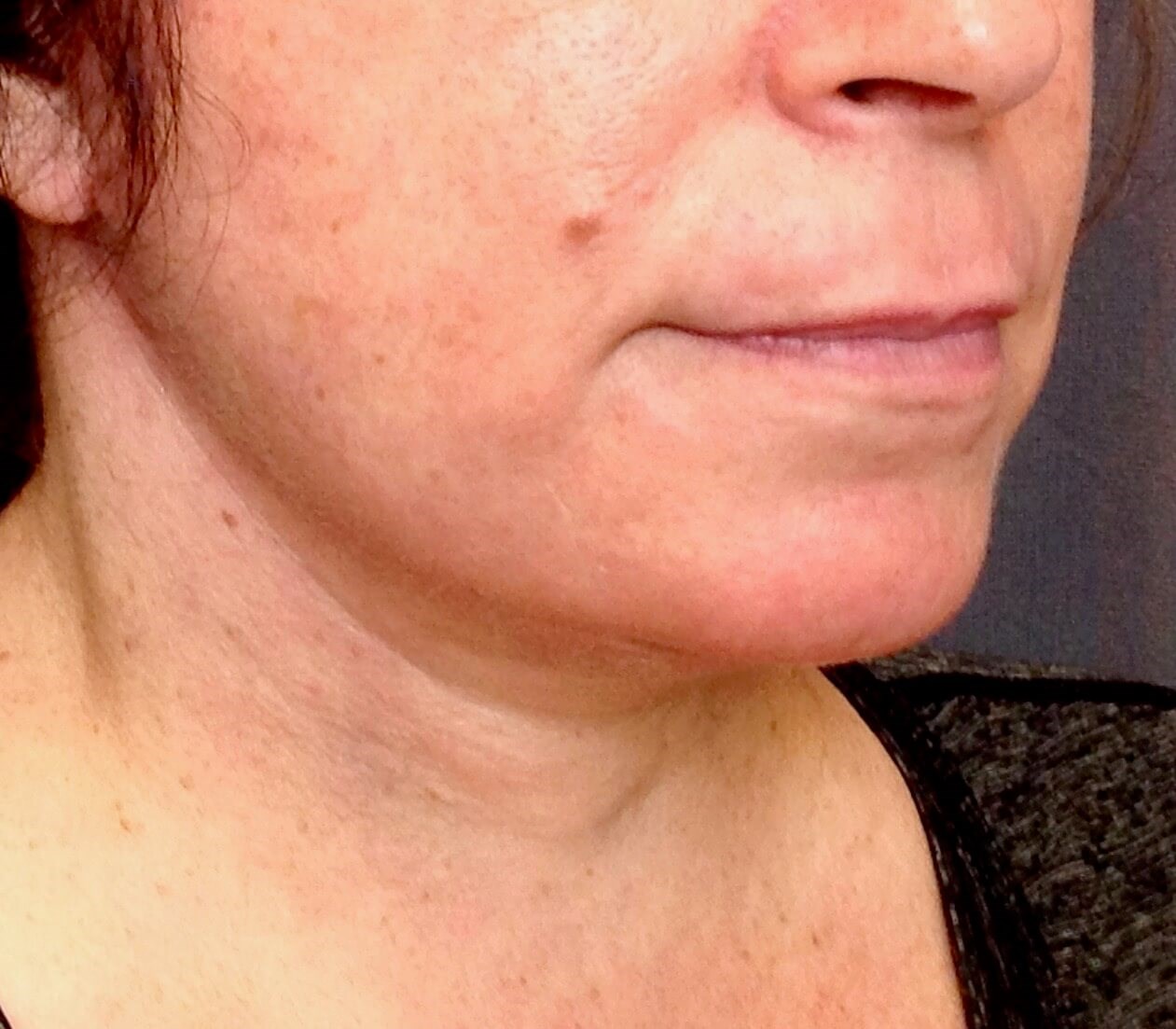 After Image