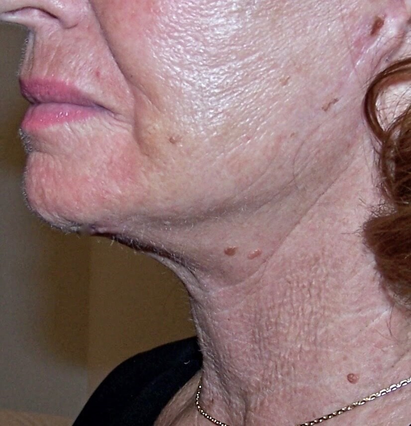 After Image